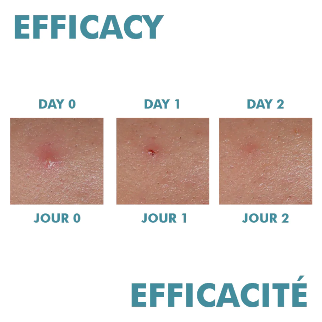 Avène Cleanance Comedomed Peeling Intensive Cream For Breakouts - Image 5