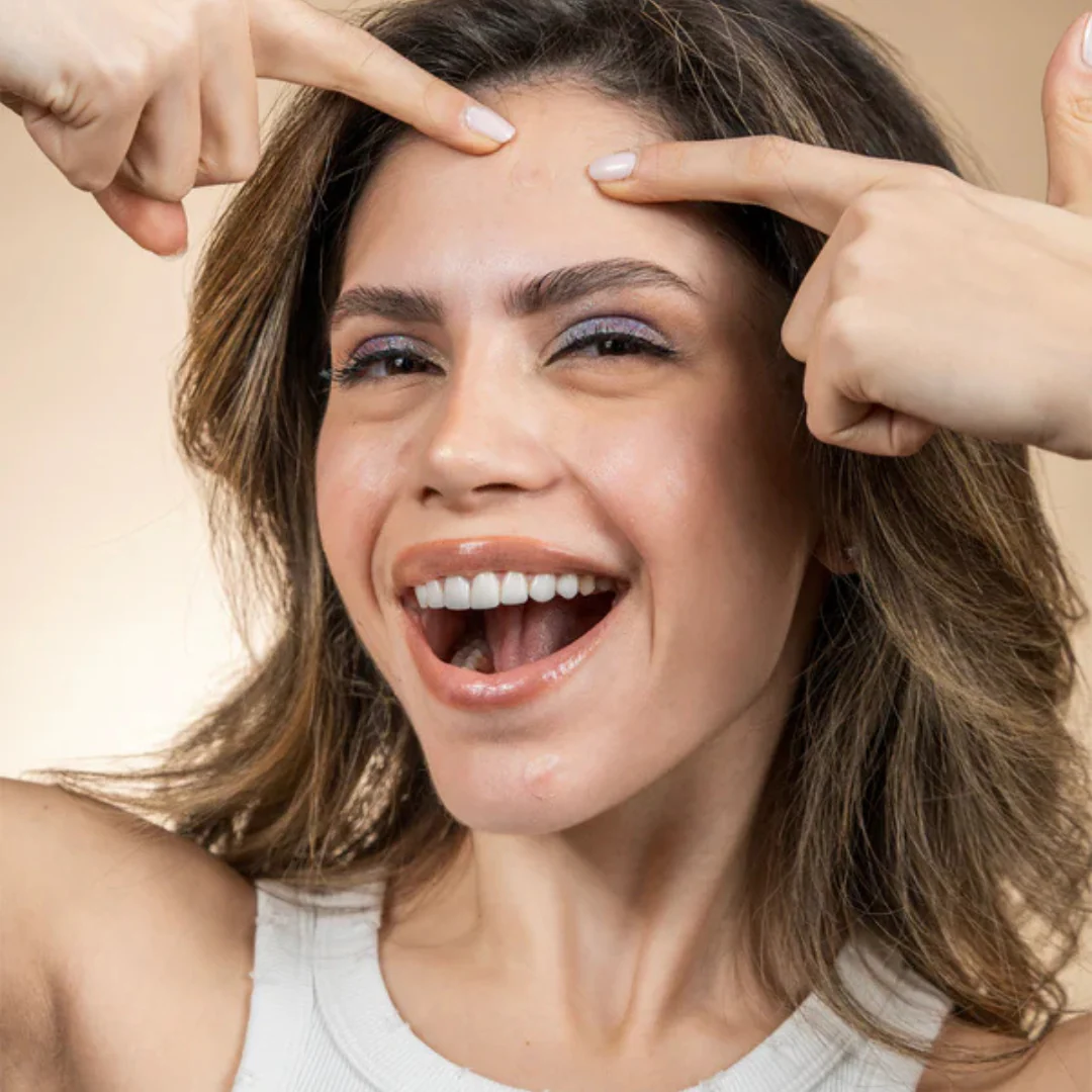 Breakfree White Spot Acne Patch - Image 3