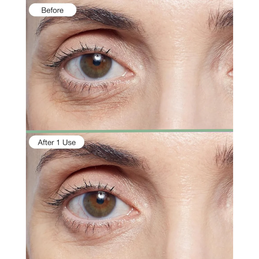 Breakfree Under Eye Hydrogel Patch - Image 4