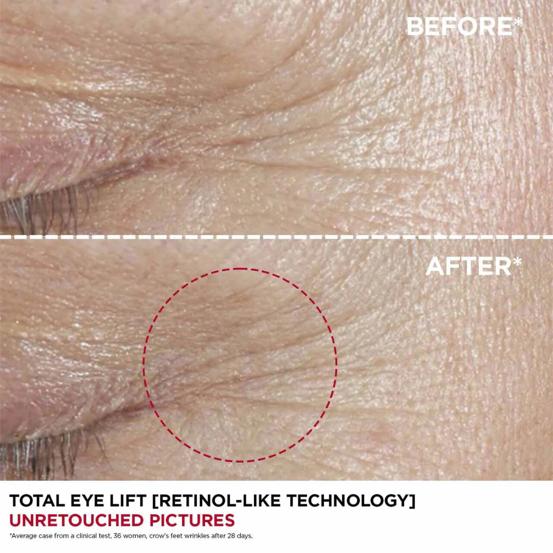 Clarins Total Eye Lift 15ml - Image 3