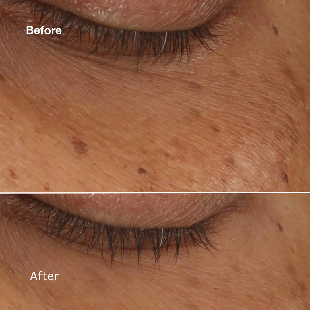 Clinique All About Eyes Brightening Serum Concentrate 10ml - Image 3