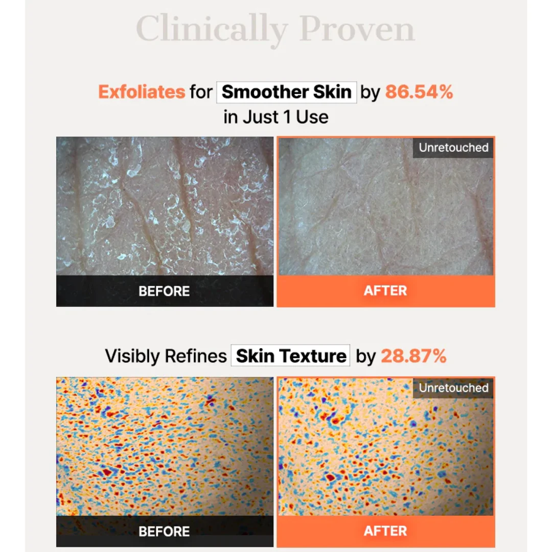 Cosrx 5 PDRN Hyaluronic Acid Vital Hydrating Hydrogel Mask - Image 9