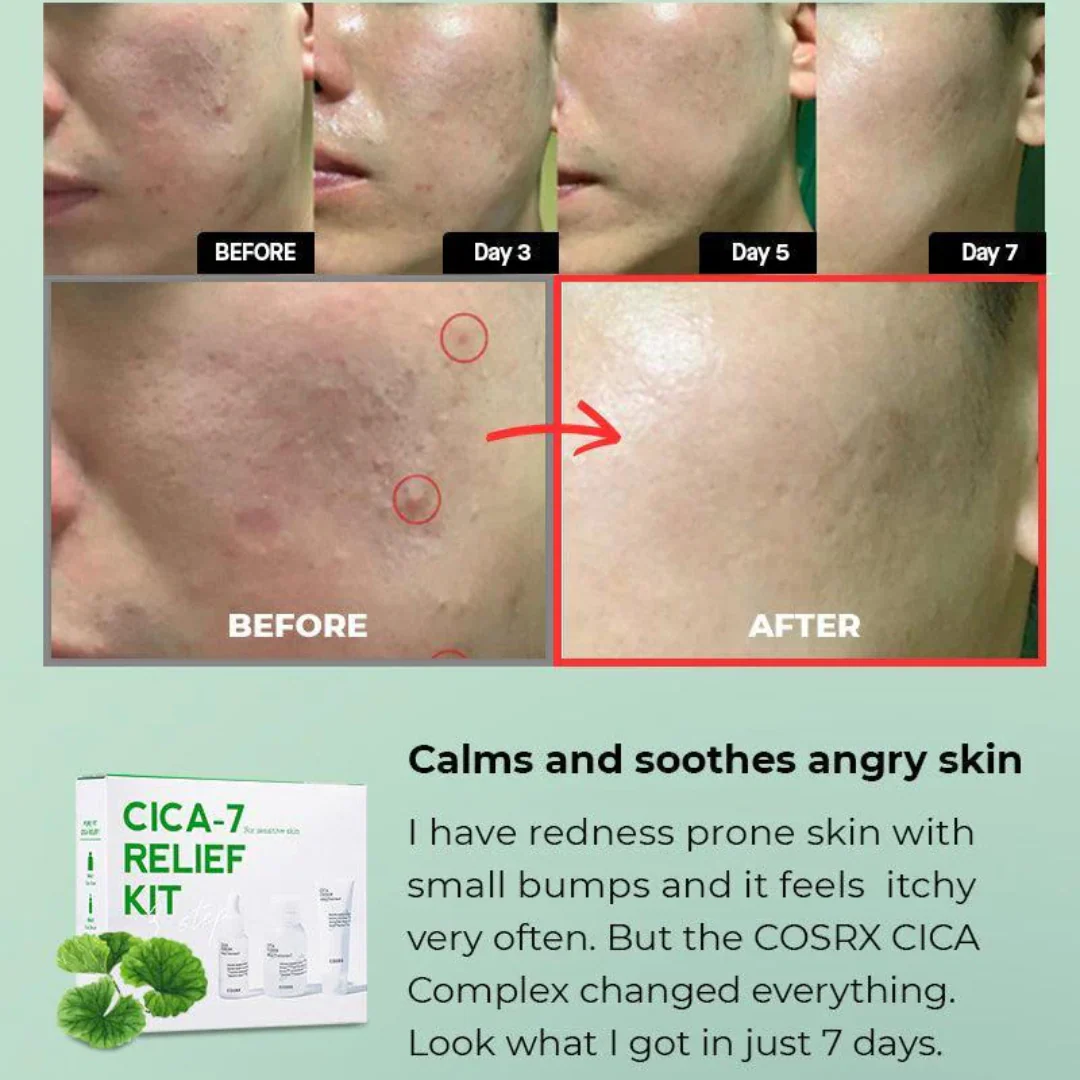Cosrx Cica-7 Relief 3 Step Kit - Image 3