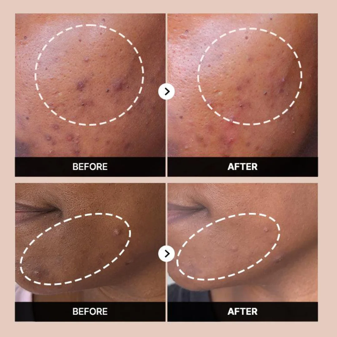Cosrx The Alpha-Arbutin 2 Discoloration Care Serum 50ml - Image 3