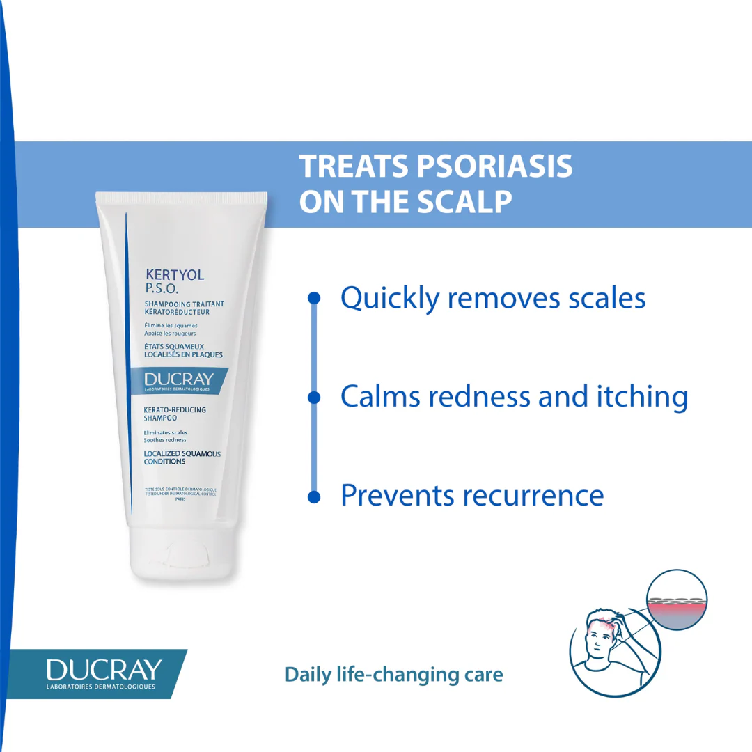 Ducray Kertyol Psoriasis Kerato-Reducing Shampoo 200ml - Image 3