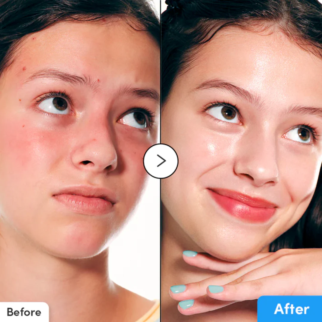 Eqqualberry Hyaltoin Flooding Serum - Image 5