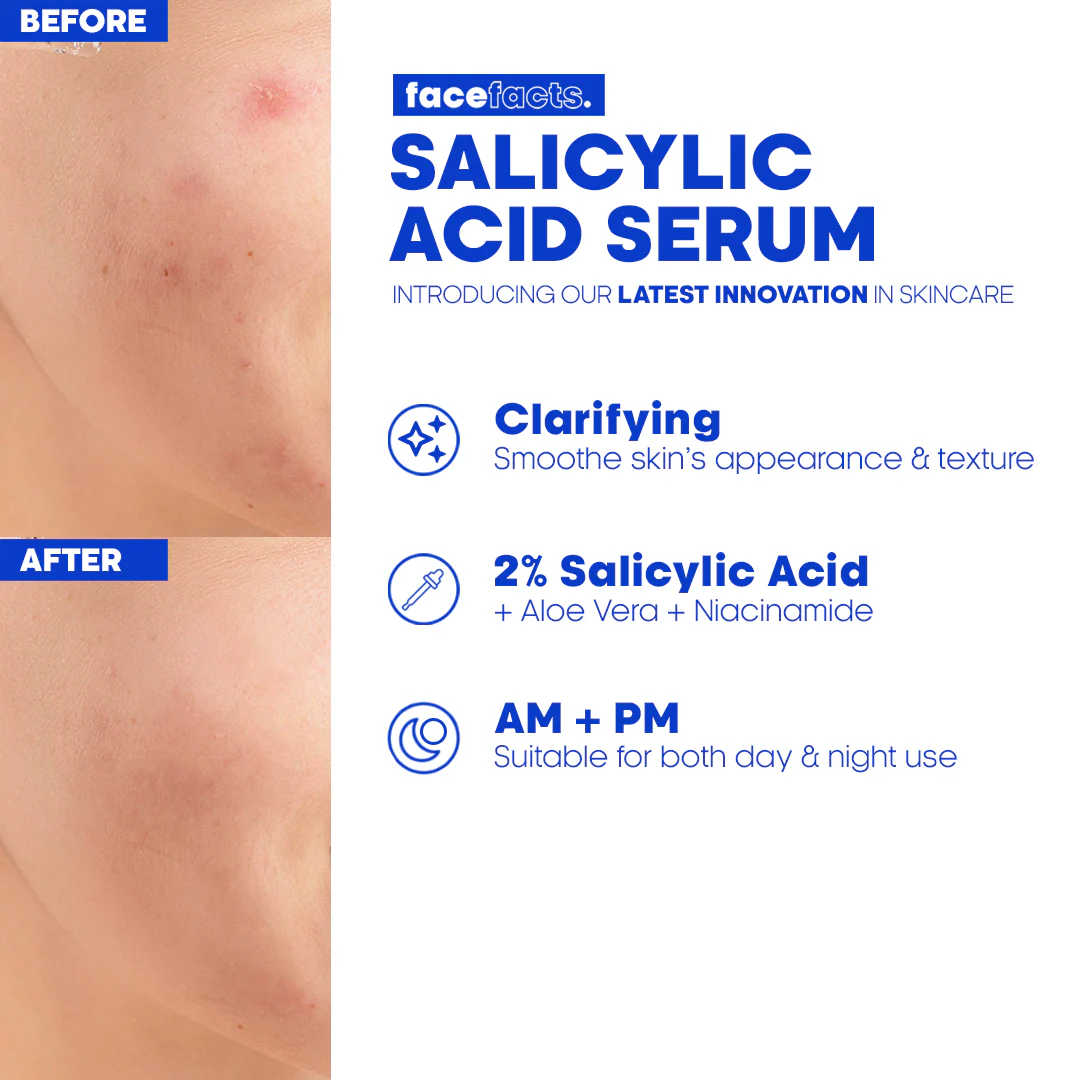 Face Facts 2% Salicylic Acid Facial Serum 30ml - Image 3