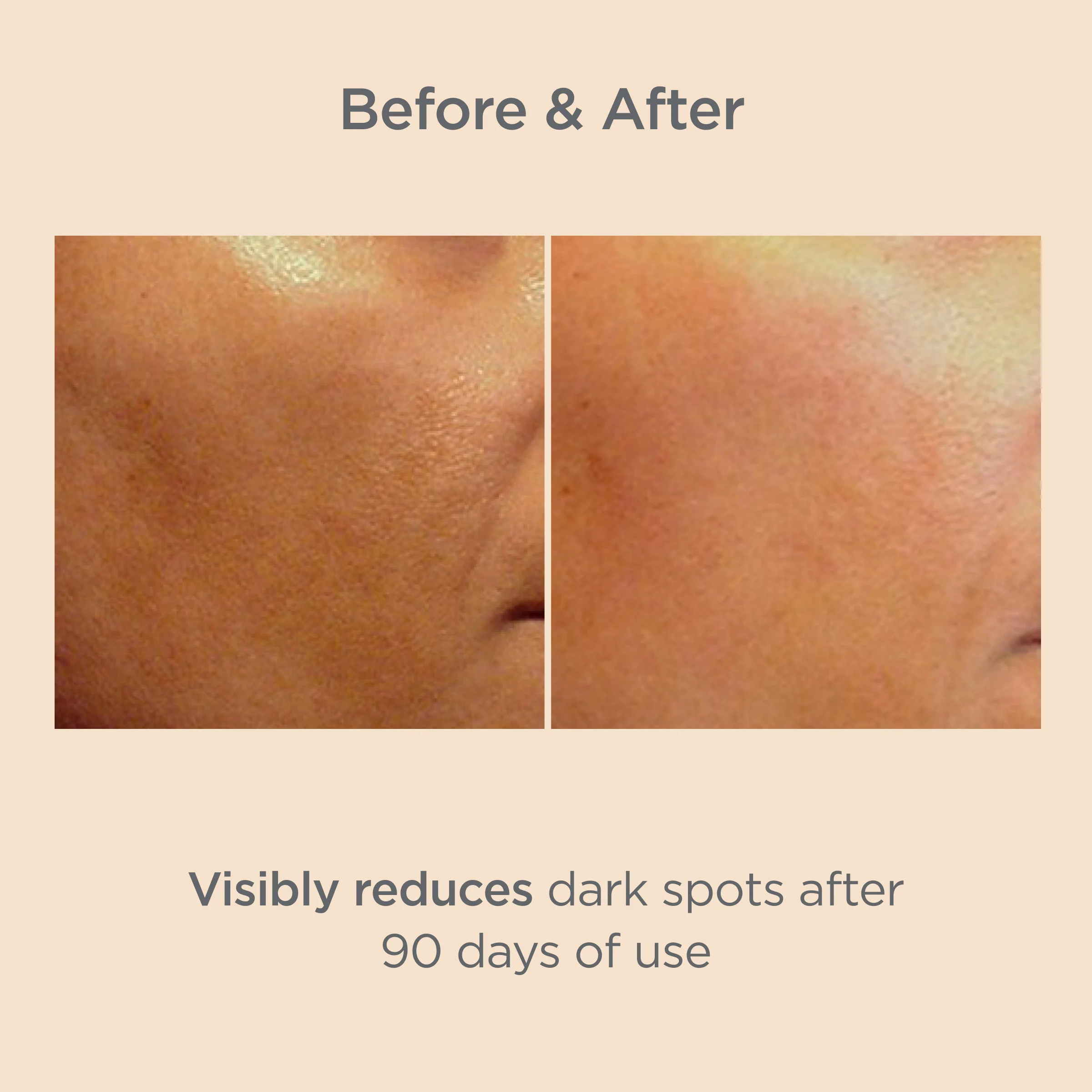 Isdin Isdinceutics Melaclear Serum 30ml - Image 2