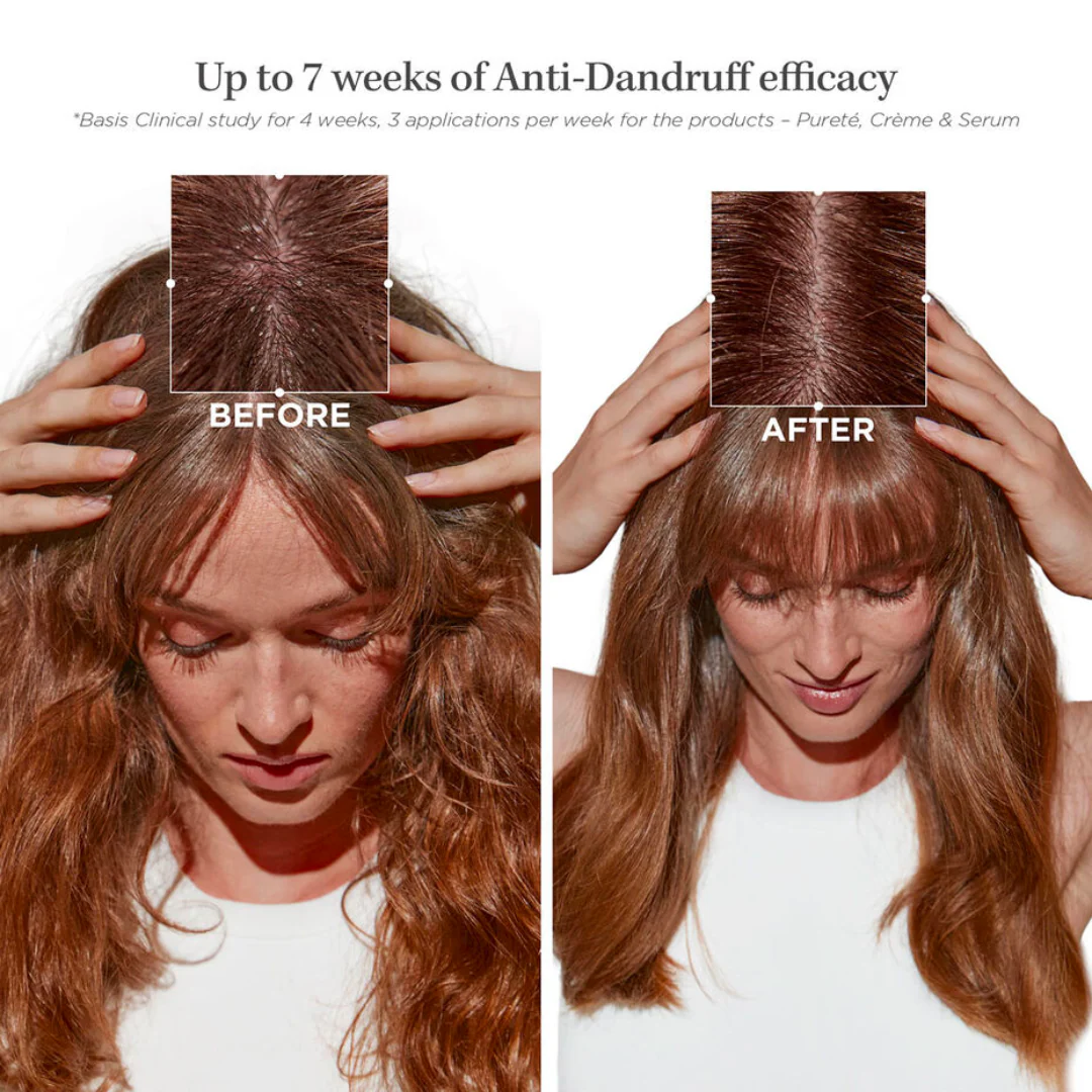 Kérastase Symbiose Purifying Anti-Dandruff Shampoo 250ml - Image 4