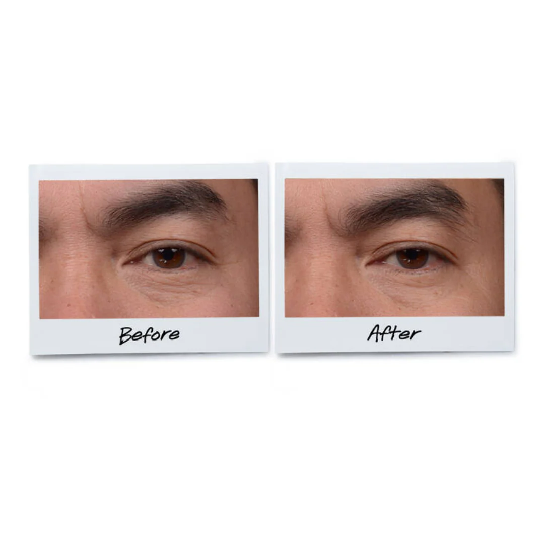 Kiehl's Age Defender Eye Repair 14ml - Image 2
