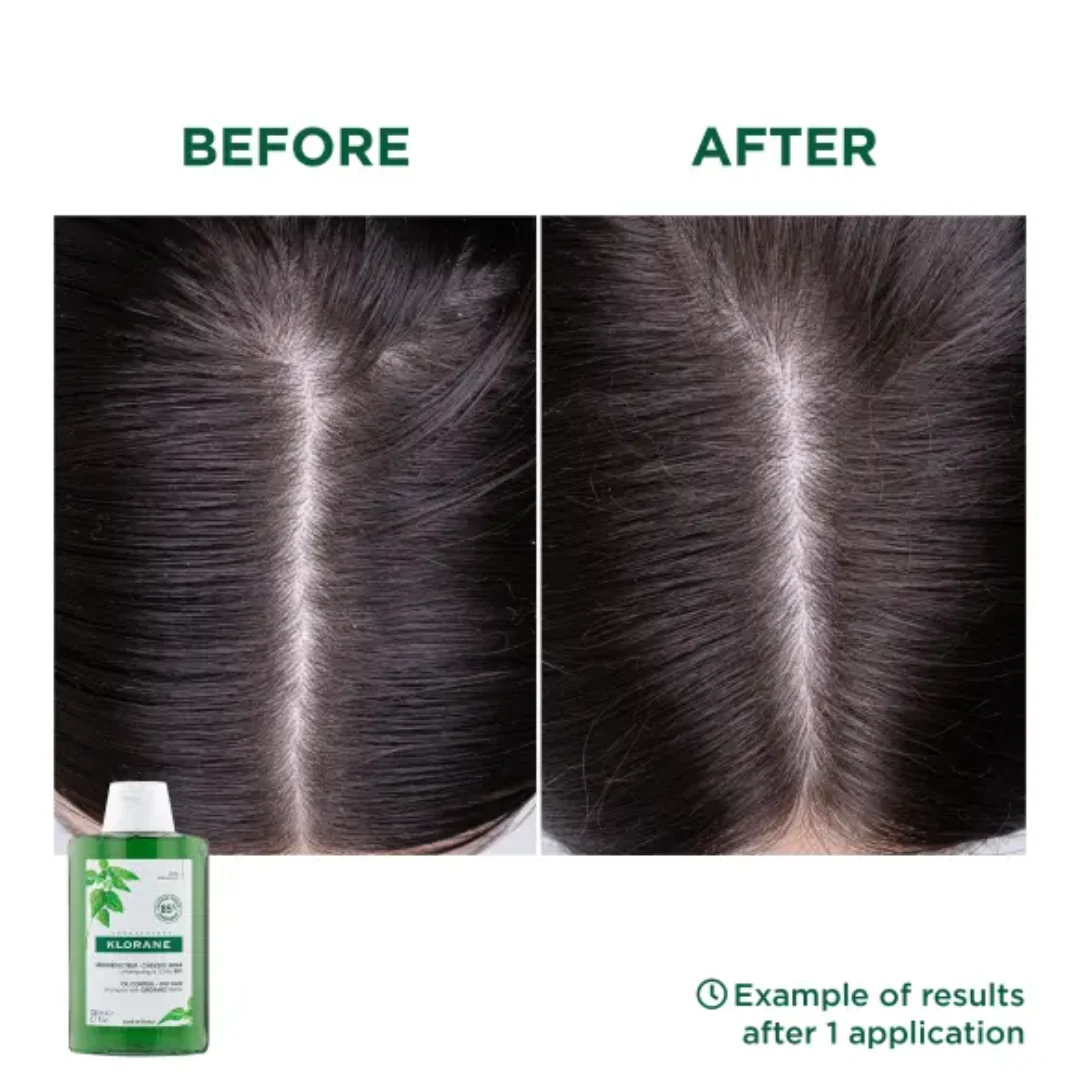 Klorane Oil-Control Shampoo with Nettle - 2 Sizes - Image 4
