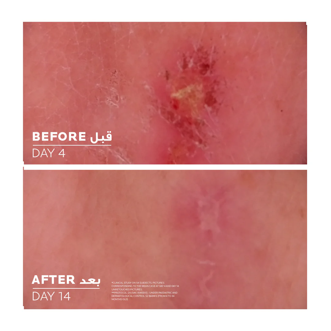 La Roche Posay Cicaplast Baume B5+ Ultra Repairing Soothing Balm - Image 3