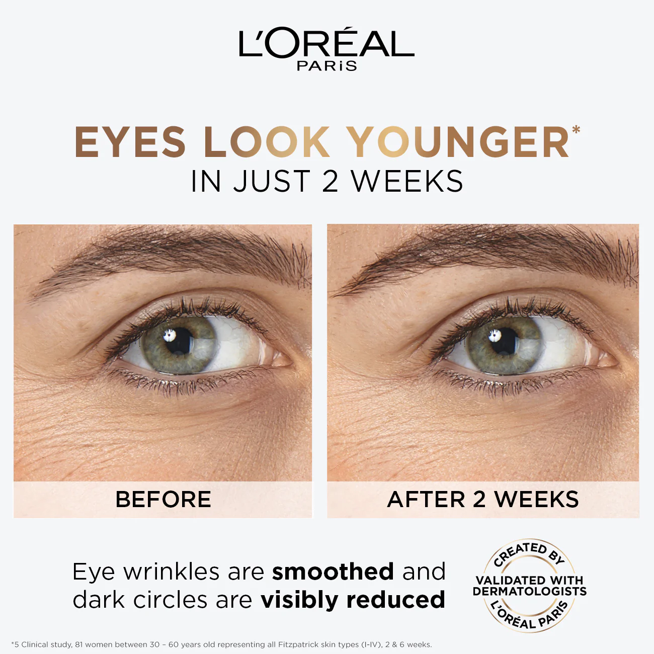 L'Oréal Paris Hyaluron Expert Moisturiser and Anti-Aging Eye Serum with 2.5% Hyaluronic Acid & Caffeine - Image 4