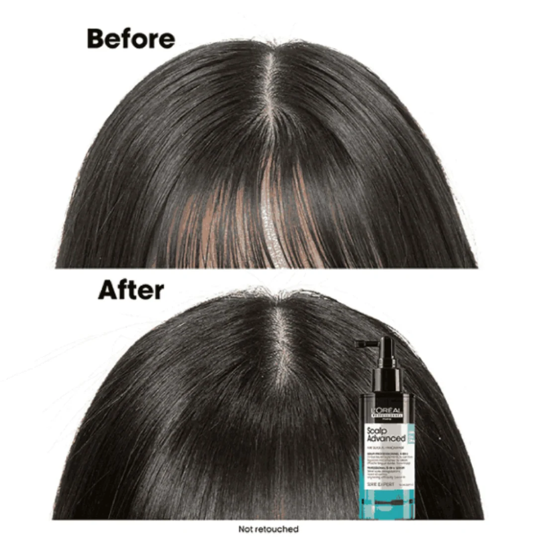 L'Oréal Professionnel Scalp Advanced Serie Expert Anti-Oiliness Serum 90ml - Image 2
