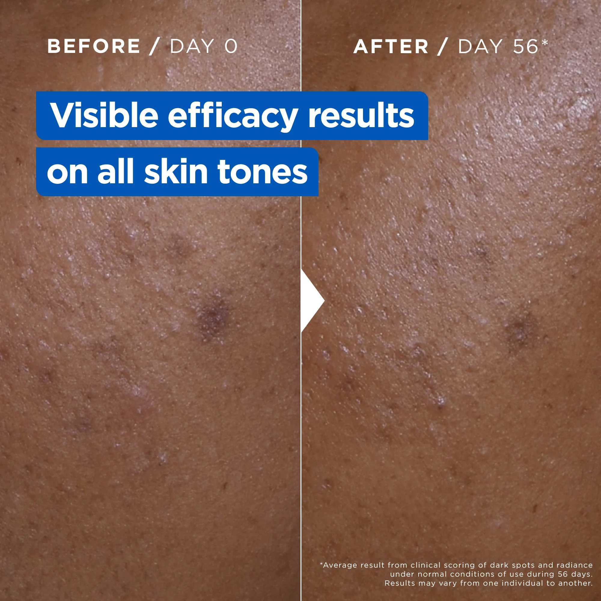 Mixa Niacinamide Bright Moisturising Anti-Dark Spot Cream Jar - Image 5
