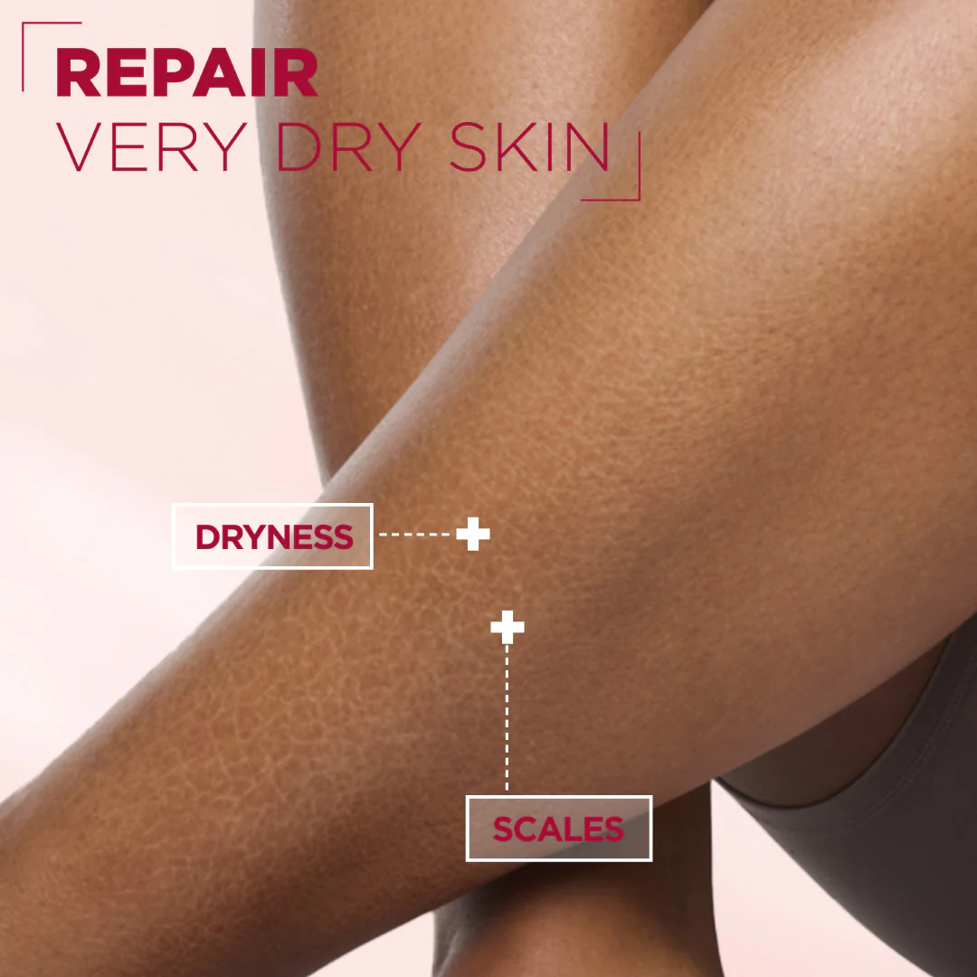 Mixa Urea Cica Repair Face, Hands & Body Cream Jar For Keratosis Pilaris, Dry Rough Fragile Skin & Tiny Reddish Bumps - Image 2