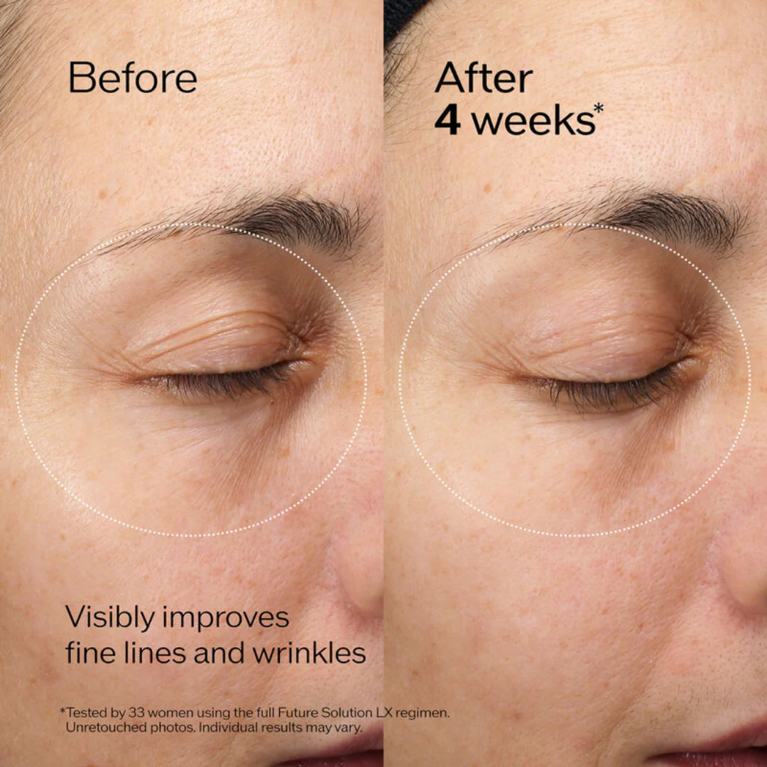 Shiseido Future Solution LX Eye And Lip Contour Regenrating Cream - Image 4