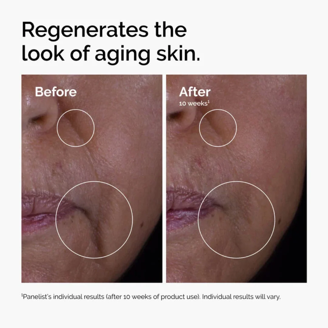 The Ordinary Gf 15% Solution Serum For Visible Skin Repair And Wrinkles - Image 4