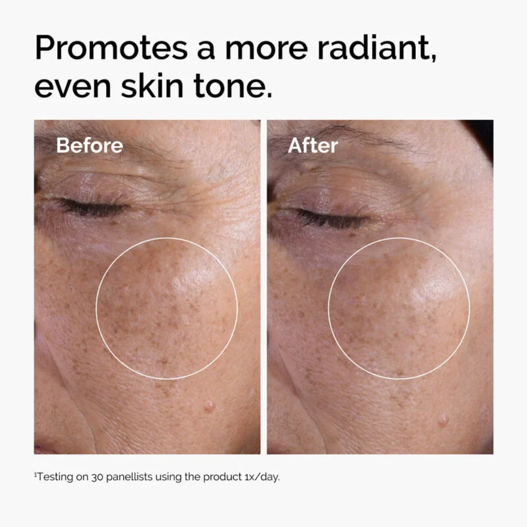 The Ordinary Glycolic Acid 7% Exfoliating And Brightening Toner - Image 5