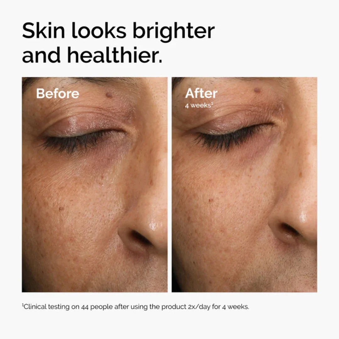 The Ordinary Multi-Antioxidant Radiance Serum With Vitamin C And Ginseng - Image 4