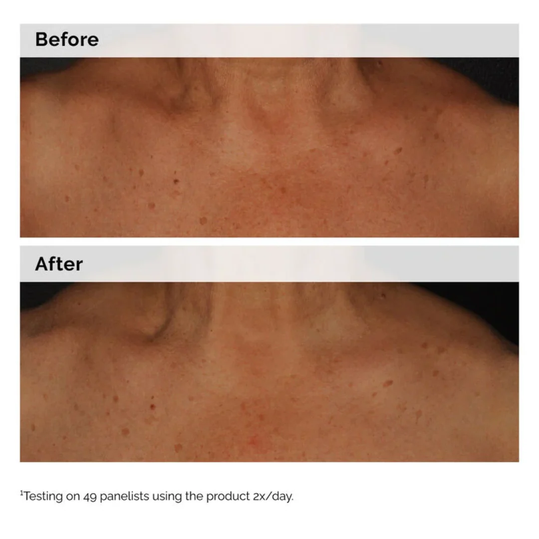 The Ordinary Niacinamide 5% Face And Body Emulsion For Dark Spots And Uneven Tone - Image 3