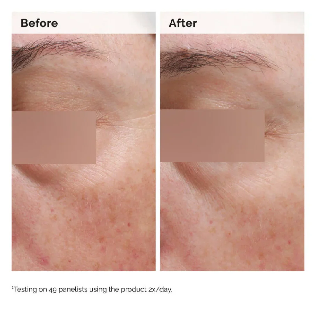 The Ordinary Niacinamide 5% Face And Body Emulsion For Dark Spots And Uneven Tone - Image 4