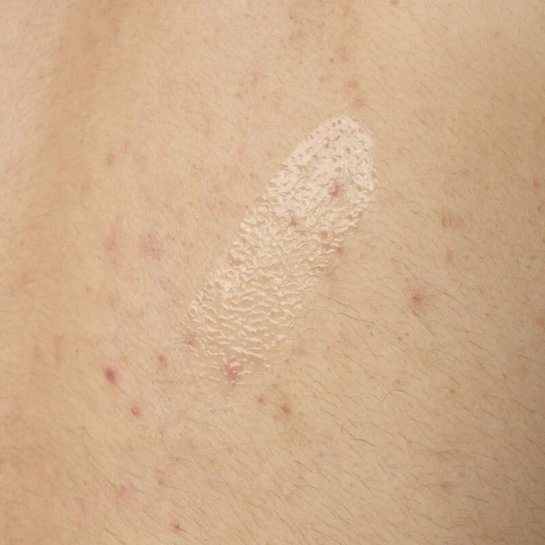 The Ordinary Salicylic Acid 0.5% Body Serum Exfoliating Treatment For Acne - Image 2