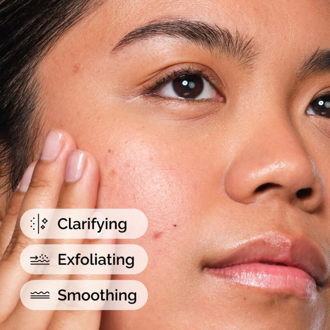 The Ordinary Salicylic Acid 2% Solution Exfoliating Serum For Acne - Image 3