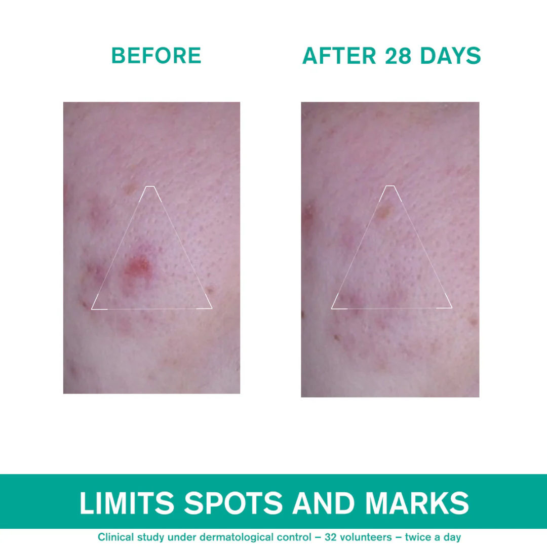 Uriage Hyséac 3-Regul + Anti-Blemish Global Care 40 ml - Image 3